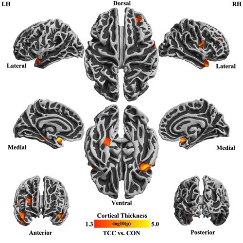 http://www.psych.cas.cn/xwzx/kyjz/201304/W020130418520379904719.jpg